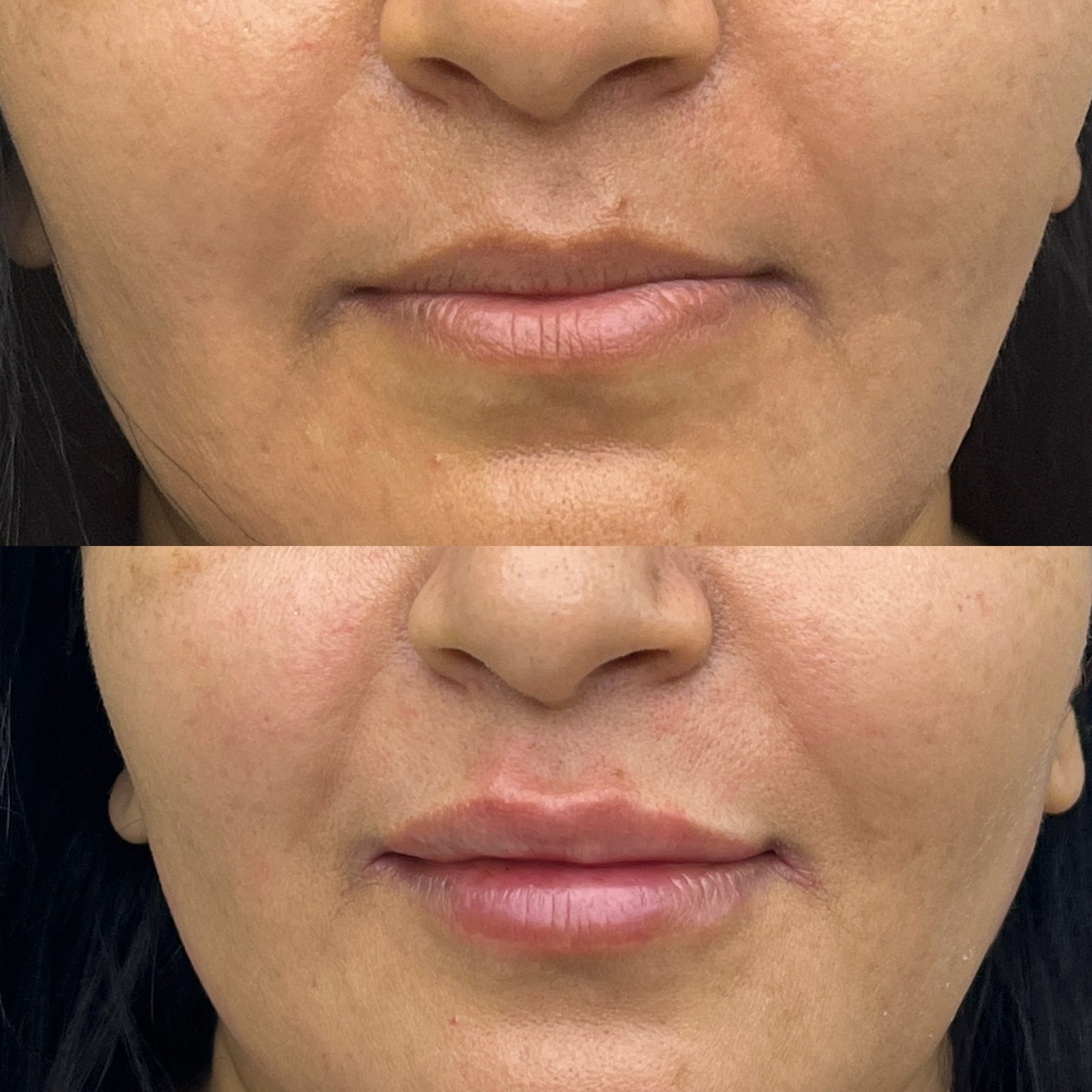 Lip Enhancement Results